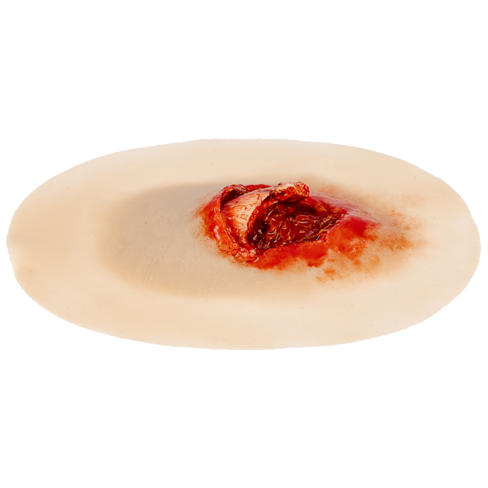 TraumaSim Self-Adhesive Open Fracture